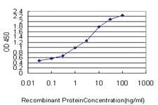 Anti-CRTAP Mouse Monoclonal Antibody [clone: 4D9]