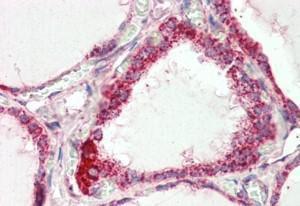 Anti-COX IV Antibody (A82550) (2.5µg/ml) staining of paraffin embedded Human Thyroid Gland. Steamed antigen retrieval with citrate buffer pH 6, AP-staining.