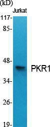 Western blot analysis of various cells using Anti-PKR1 Antibody