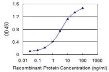 Anti-LDB3 Mouse Monoclonal Antibody [clone: 2C1]