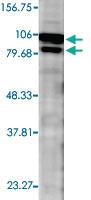 Anti-CANX Rabbit Polyclonal Antibody