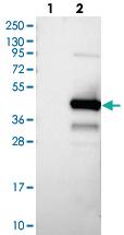 Anti-KTI12 Rabbit Polyclonal Antibody