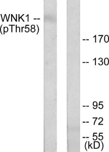 Western blot analysis of lysates from 293 cells treated with EGF 200ng/ml 30' using Anti-WNK1 (phospho Thr58) Antibody. The right hand lane represents a negative control, where the antibody is blocked by the immunising peptide