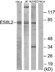 Western blot analysis of lysates from HeLa, Jurkat, and HUVEC cells using Anti-ES8L2 Antibody. The right hand lane represents a negative control, where the Antibody is blocked by the immunising peptide