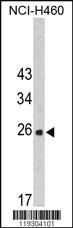 Anti-FKBP14 Rabbit Polyclonal Antibody