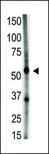 Anti-GDF5 Rabbit Polyclonal Antibody (HRP (Horseradish Peroxidase))