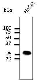 HaCaT cell lysate detected with Anti-CAV1 Antibody at a 1:1,000 dilution Lysate at 100 µg and rabbit anti-goat IgG antibody (HRP) at a 1:10,000 dilution