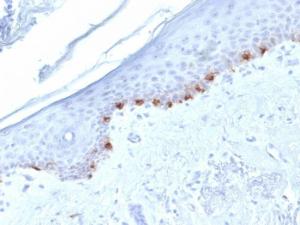 Immunohistochemical analysis of formalin-fixed, paraffin-embedded human skin using Anti-TRP1 Antibody [TYRP1/1986]