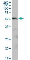 Anti-PIAS2 Mouse Polyclonal Antibody