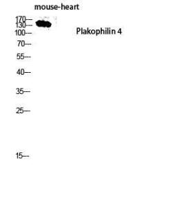 Western blot analysis of mouse heart lysis using Anti-PKP4 Antibody