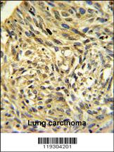 Anti-FKBP14 Rabbit Polyclonal Antibody