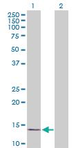 Anti-RPLP1 Mouse Polyclonal Antibody