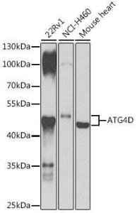 Western blot analysis of extracts of various cell lines, using Anti-ATG4D Antibody (A307580) at 1:1,000 dilution The secondary antibody was Goat Anti-Rabbit IgG H&L Antibody (HRP) at 1:10,000 dilution Lysates/proteins were present at 25 µg per lane