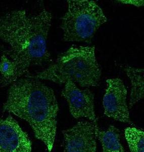 Hepa 1-6 cells, fixed with 4% PFA, stained with Anti-CAV1 Antibody at a 1:50 dilution