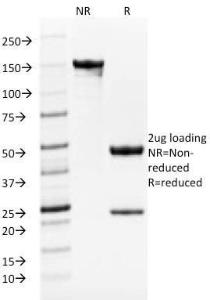 SDS-PAGE analysis of Anti-TRP1 Antibody [TYRP1/1986] under non-reduced and reduced conditions; showing intact IgG and intact heavy and light chains, respectively. SDS-PAGE analysis confirms the integrity and purity of the antibody