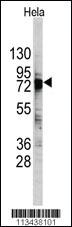 Anti-PTMA Rabbit Polyclonal Antibody