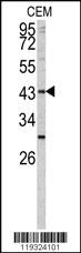 Anti-FUT1 Rabbit Polyclonal Antibody