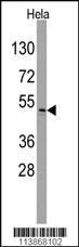 Anti-ILK Rabbit Polyclonal Antibody