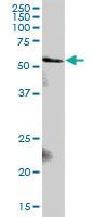 Anti-PIAS2 Mouse Polyclonal Antibody