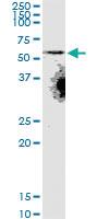 Anti-SLC22A8 Mouse Monoclonal Antibody [clone: 3C11]