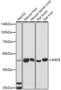 Anti-MEPEELISAKit antibody