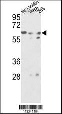 Anti-GNS Rabbit Polyclonal Antibody