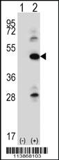 Anti-ILK Rabbit Polyclonal Antibody