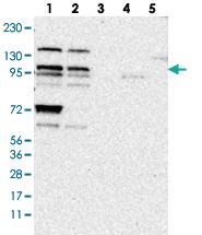 Anti-ZNF518B Rabbit Polyclonal Antibody