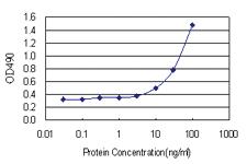 Anti-SMPDL3B Polyclonal Antibody Pair