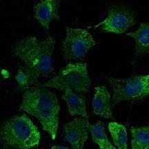 Hepa 1-6 cells, fixed with 4% PFA, stained with Anti-CAV1 Antibody at a 1:50 dilution