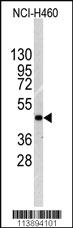 Anti-ILK Rabbit Polyclonal Antibody