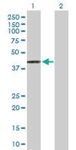 Anti-HLAA Rabbit Polyclonal Antibody