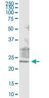 Anti-RAB38 Polyclonal Antibody Pair