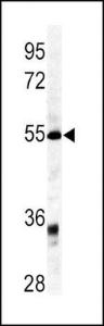 Anti-GDF6 Rabbit polyclonal antibody