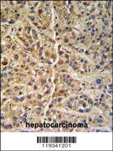 Anti-GNS Rabbit Polyclonal Antibody