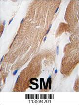 Anti-ILK Rabbit Polyclonal Antibody