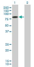 Anti-PIAS2 Mouse Polyclonal Antibody