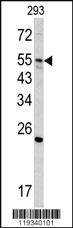 Anti-GNS Rabbit Polyclonal Antibody