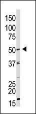 Anti-GDF9 Rabbit Polyclonal Antibody (AP (Alkaline Phosphatase))