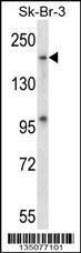 Anti-MAP4K4 Rabbit Polyclonal Antibody (FITC (Fluorescein Isothiocyanate))