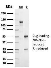 SDS-PAGE analysis of Anti-p53 Antibody [TP53/7002R] under non-reduced and reduced conditions; showing intact IgG and intact heavy and light chains, respectively SDS-PAGE analysis confirms the integrity and purity of the antibody