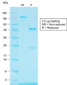 SDS-PAGE analysis of Anti-TRP1 Antibody [TYRP1/1564R] under non-reduced and reduced conditions; showing intact IgG and intact heavy and light chains, respectively. SDS-PAGE analysis confirms the integrity and purity of the antibody