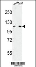 Anti-KCNC3 Rabbit Polyclonal Antibody