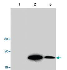 Anti-ACAN Mouse Monoclonal Antibody [clone: N38]