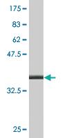 Anti-FAAH Mouse Monoclonal Antibody [clone: 7C9]