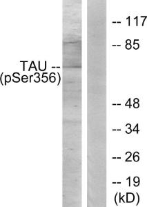 Western blot analysis of lysates from 293 cells treated with serum 10% 15' using Anti-Tau (phospho Ser356) Antibody. The right hand lane represents a negative control, where the antibody is blocked by the immunising peptide