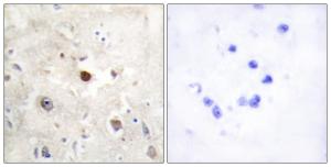 Immunohistochemical analysis of paraffin-embedded human brain using Anti-p57KIP2 Antibody. The right hand panel represents a negative control, where the antibody was pre-incubated with the immunising peptide.