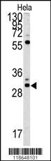 Anti-MPST Rabbit Polyclonal Antibody