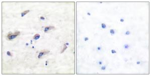 Immunohistochemical analysis of paraffin-embedded human brain using Anti-Tau (phospho Ser356) Antibody. The right hand panel represents a negative control, where the antibody was pre-incubated with the immunising peptide