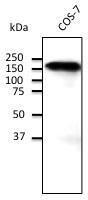 Endogenous CDH1 detected with Anti-CDH1 Antibody at a 1:500 dilution. Lysate at 100 µg and rabbit anti-goat IgG antibody (HRP) at a 1:10000 dilution